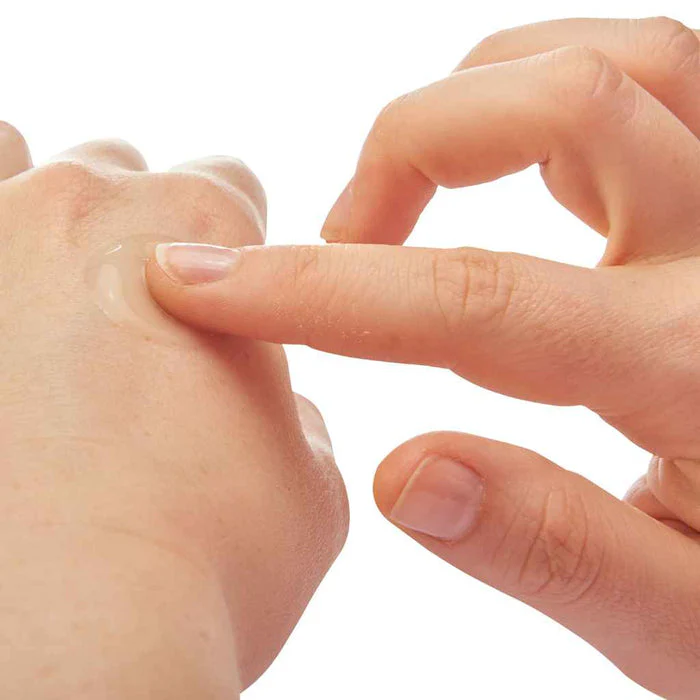 The Itch Eraser Gel - 2 oz. - Image 8